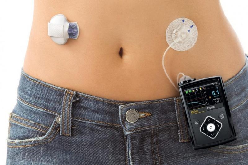 Patch Insulin Pumps