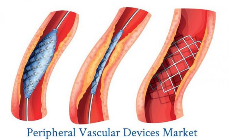 Peripheral Vascular Devices