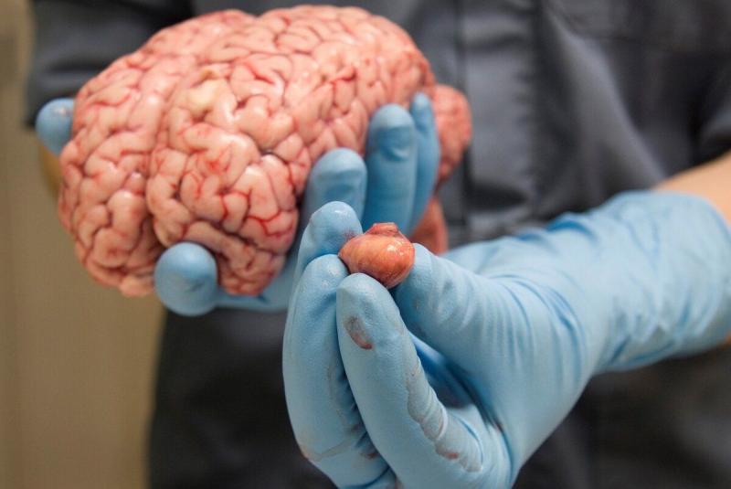 Pituitary Cancer Market