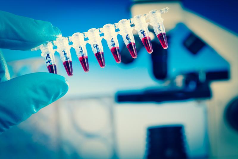 Global Plasma Protein Therapeutic Market