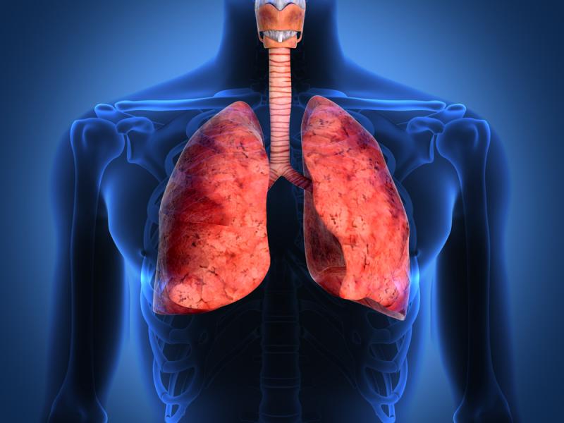 Pleural Diseases