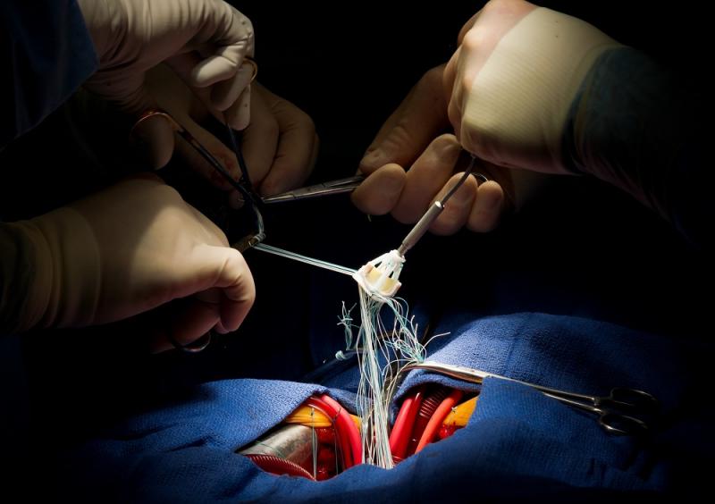 Prosthetic Heart Valves Market