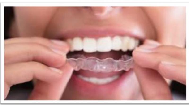 Why Bi-Annual Dental Checkup is Important?