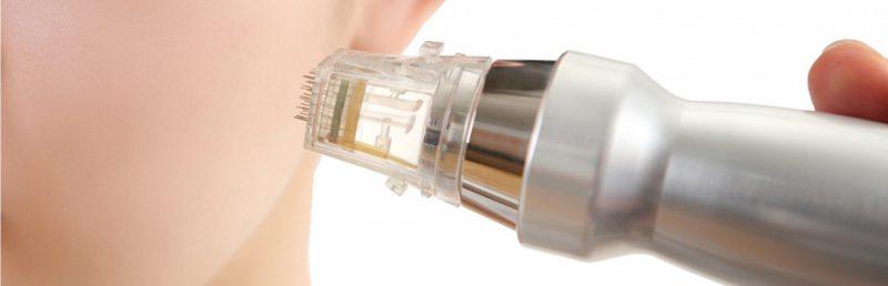 Radiofrequency Industry 