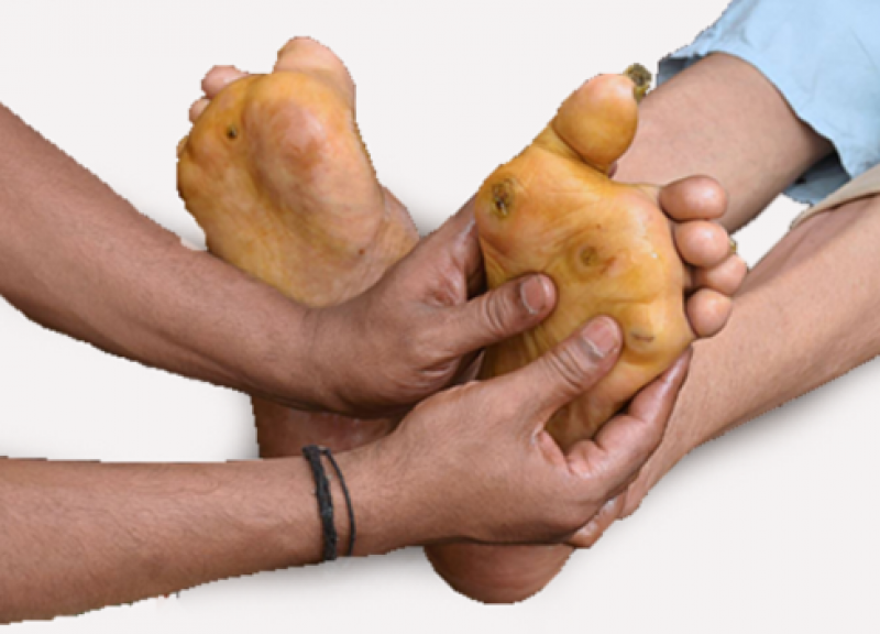  Get Best Arthritis Treatment Center Nagpur 