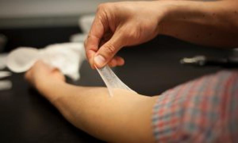 Regenerative Artificial Skin Market