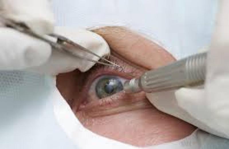 Retinal Surgery Devices