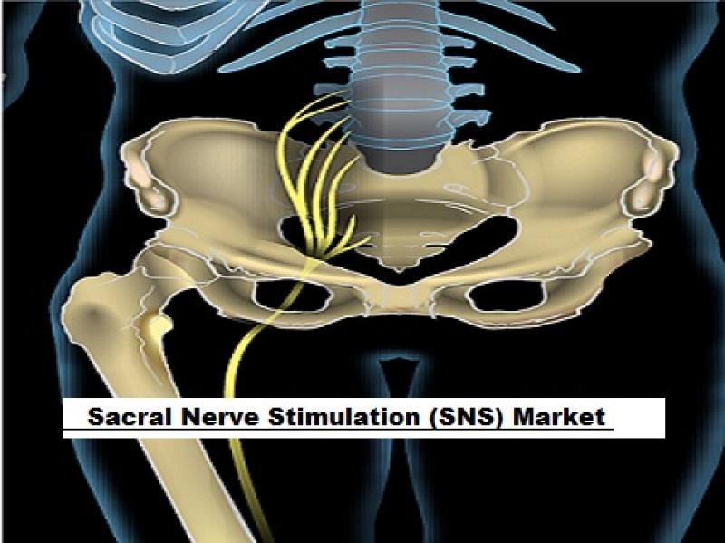 Sacral Nerve Stimulation Market