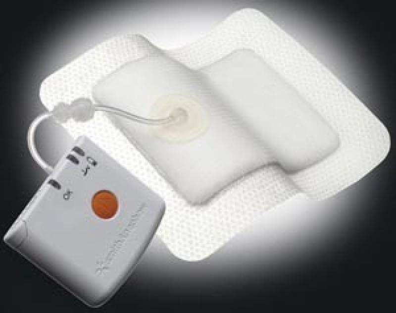 Single-use Negative Pressure Wound Therapy Device