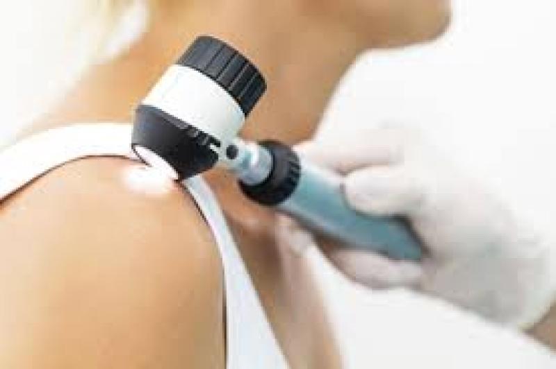 Skin Cancer Diagnostics