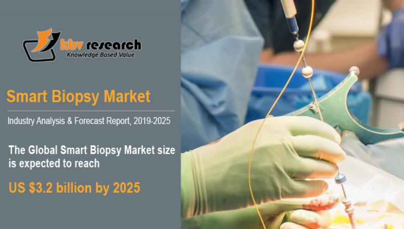 Smart Biopsy Market