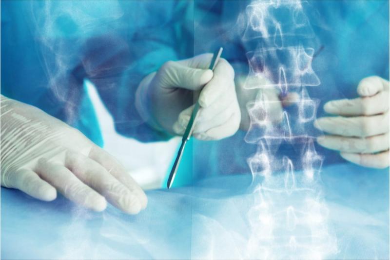 Spinal Implants and Surgical Devices