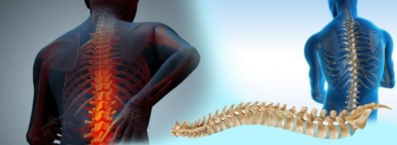 Spinal Surgery Devices