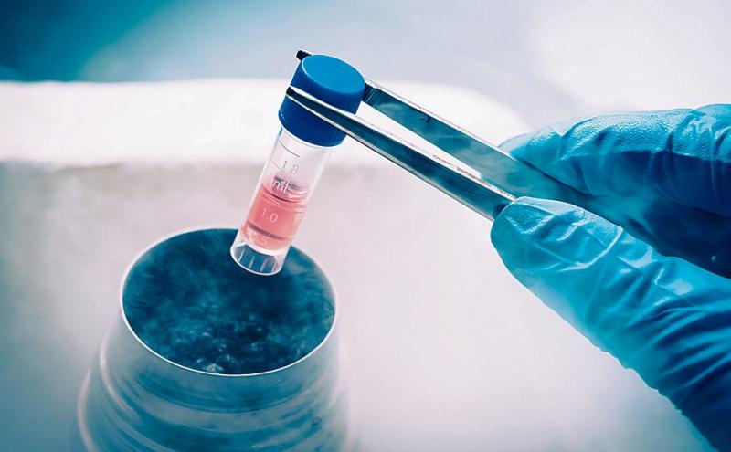 Stem Cell Banking Market Research Report 2018 Stem Cell Banking