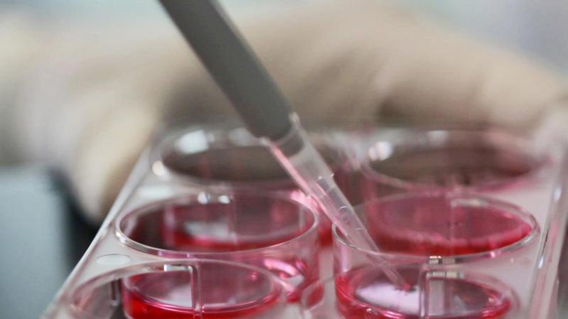 Stem Cell Banking
