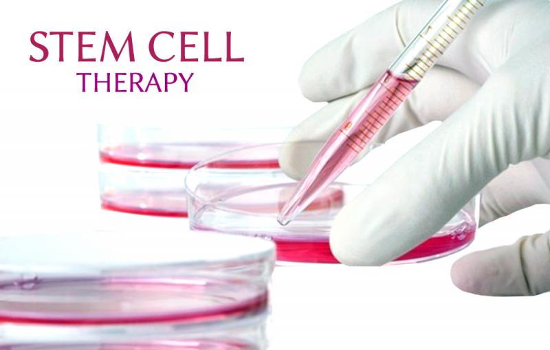 Stem Cell Therapy Industry