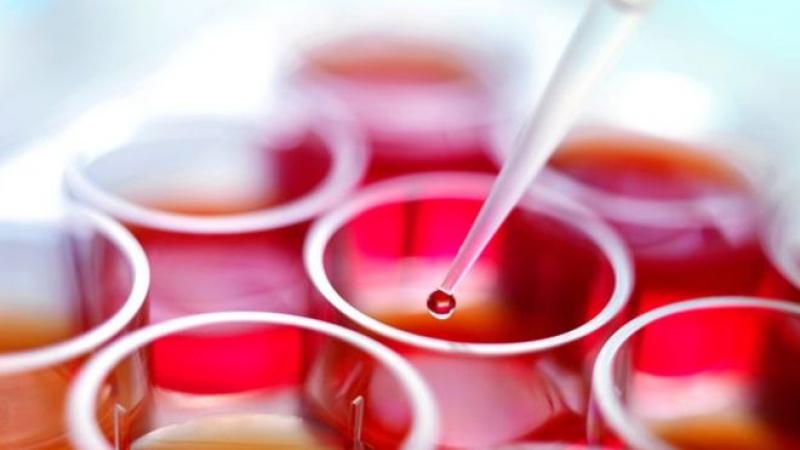 Stem Cell Transplantation