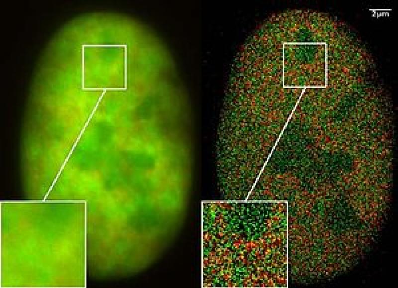 Super-resolution Microscopes Market