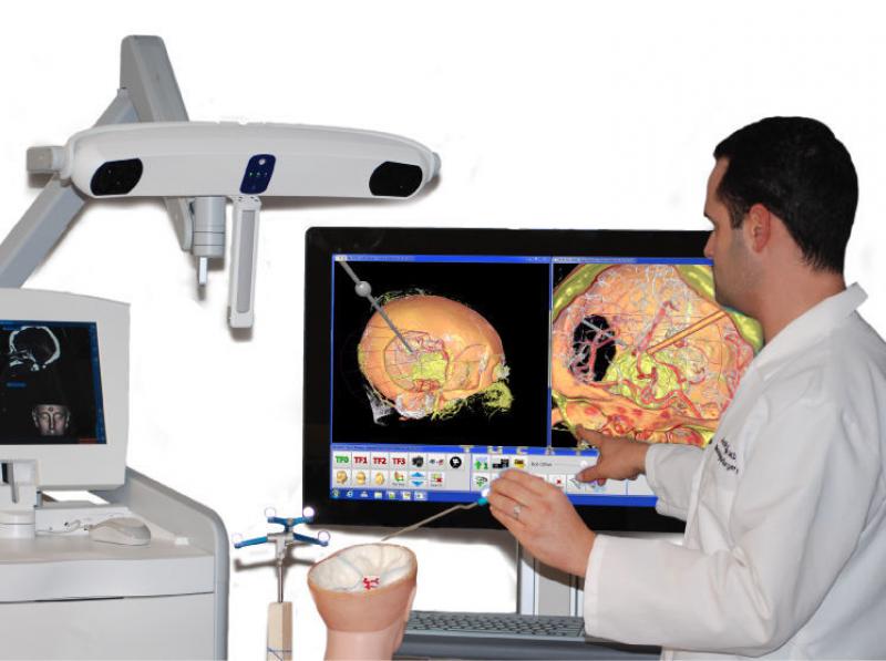 Surgical Navigation Systems Market