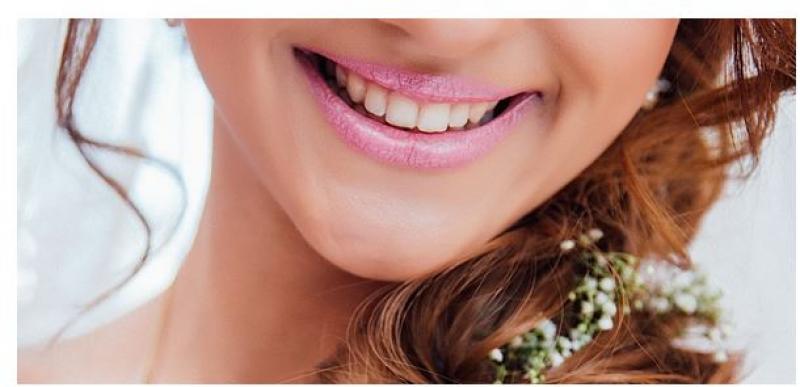 What to Expect When Getting Braces off