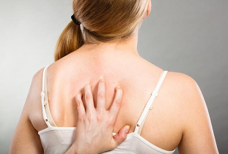 Tinea Corporis Market Size