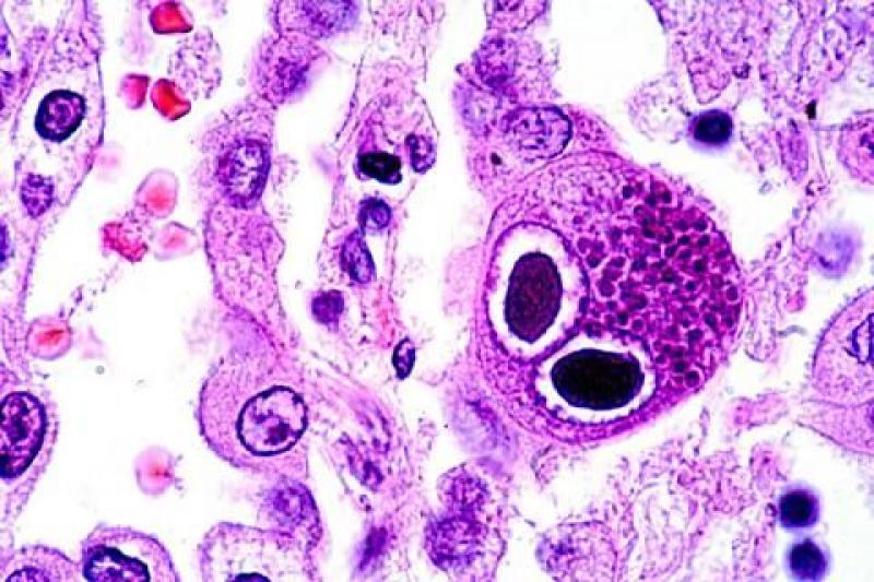 Tissue Engineering and Regeneration Market