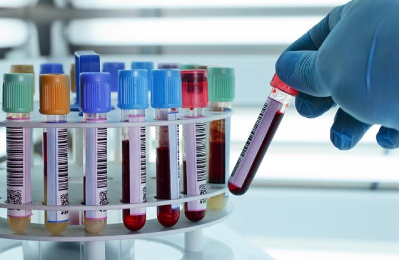 Transfusion Diagnostic Equipment Market