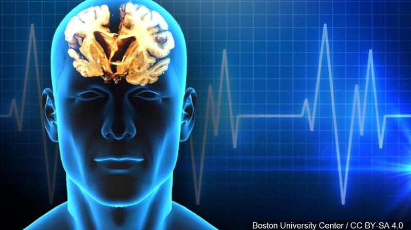  Traumatic Brain Injury