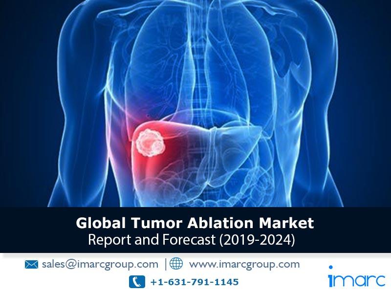 Tumor Ablation Market