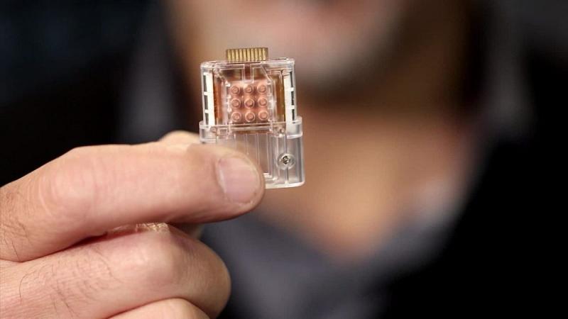 US Biochip Products and Services Market