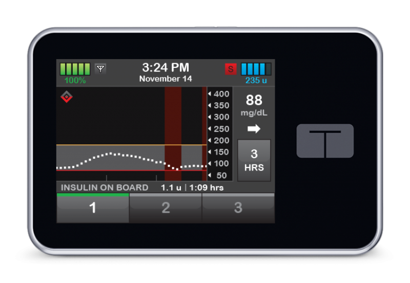 United States Insulin Pump Market 