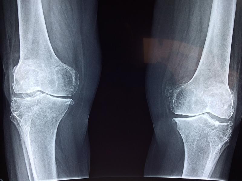 Uterine Sarcoma Treatment Market