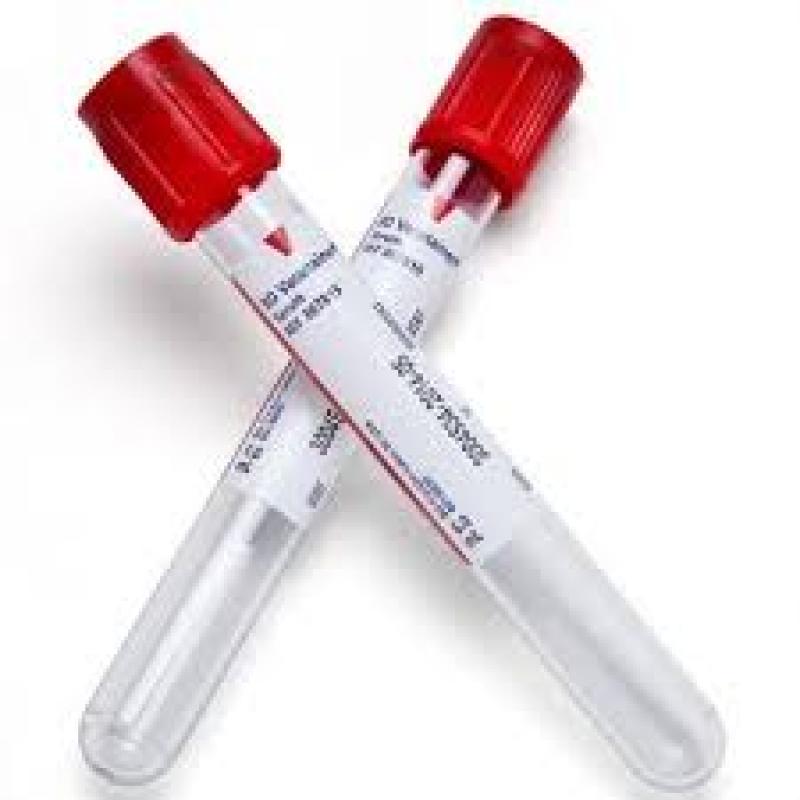 World Venous Blood Collection Tube Market 
