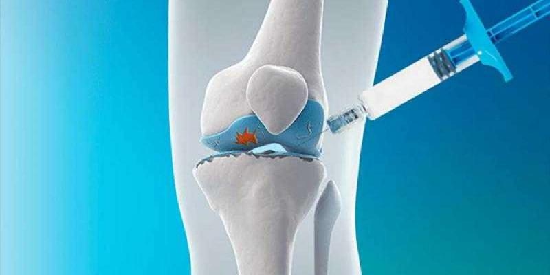 Viscosupplementation Market