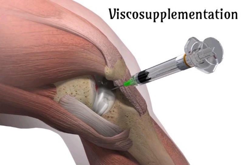 Viscosupplementation Market