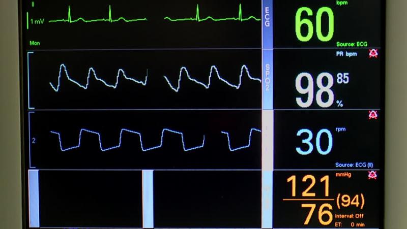 Vital Parameter Monitoring Devices And Equipment Market Size, Growth, Drivers, Trends And Forecast