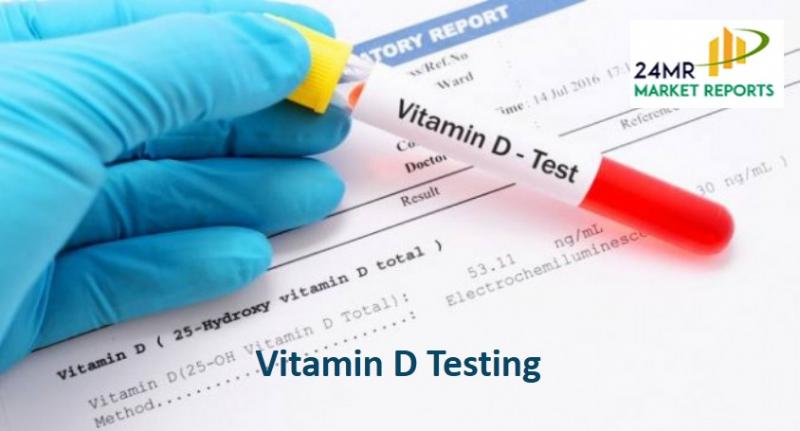 2017-2022 Global and Regional Vitamin D Testing Industry Production, Sales and Consumption Status and Prospects Professional Market Research Report Vitamin D Testing
