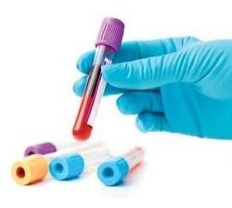 Vitamin D Testing Market