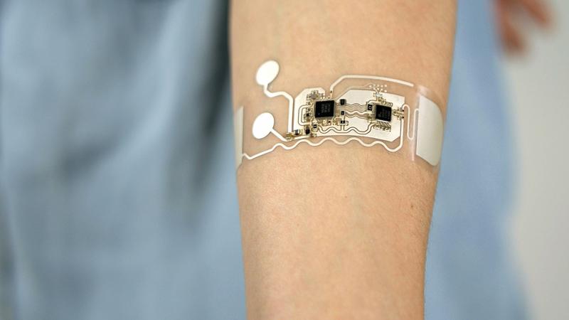 Wearable Sensor Market