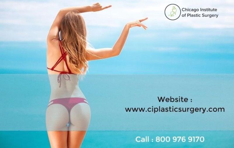 brazilian butt lift surgery in chicago