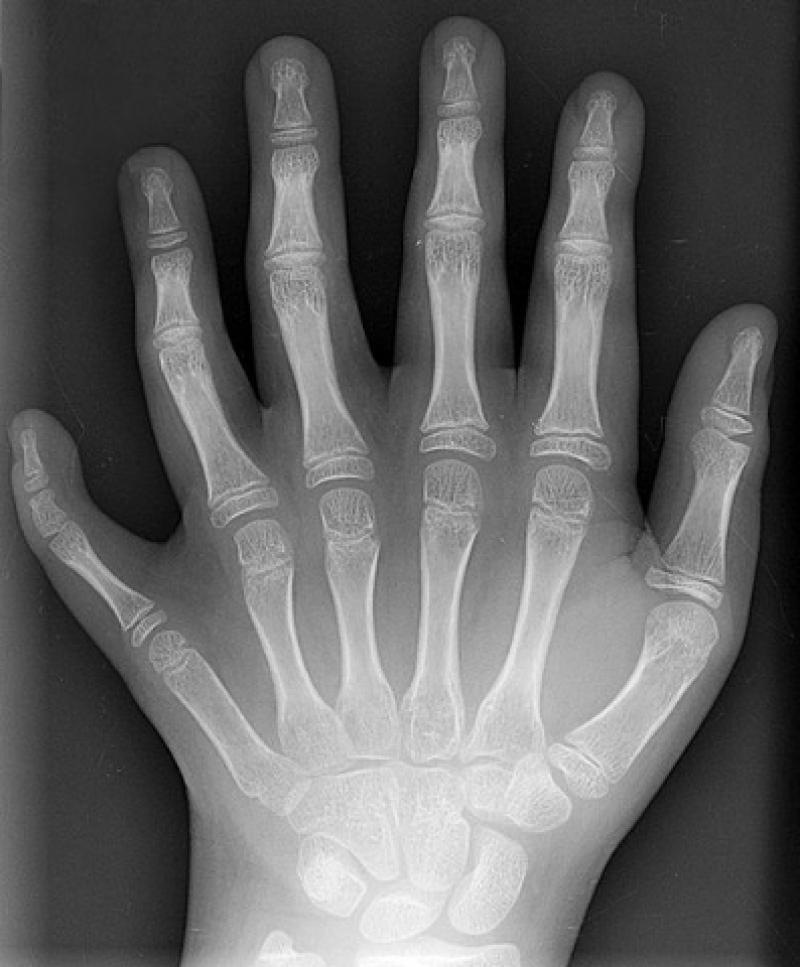 X-ray Computed Tomography System