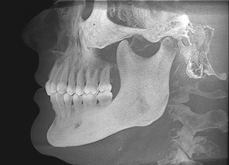 CBCT Dental Imaging