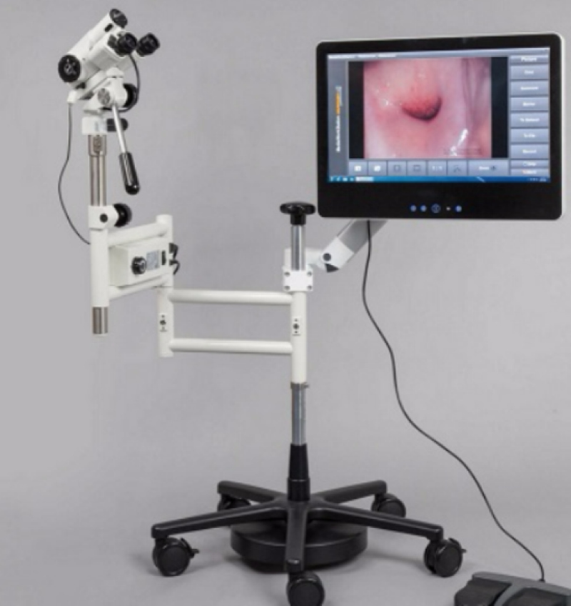 Global Cervical Cancer Diagnostics and Therapeutics Market-2016 Cervical Cancer Diagnostics and Therapeutics Market