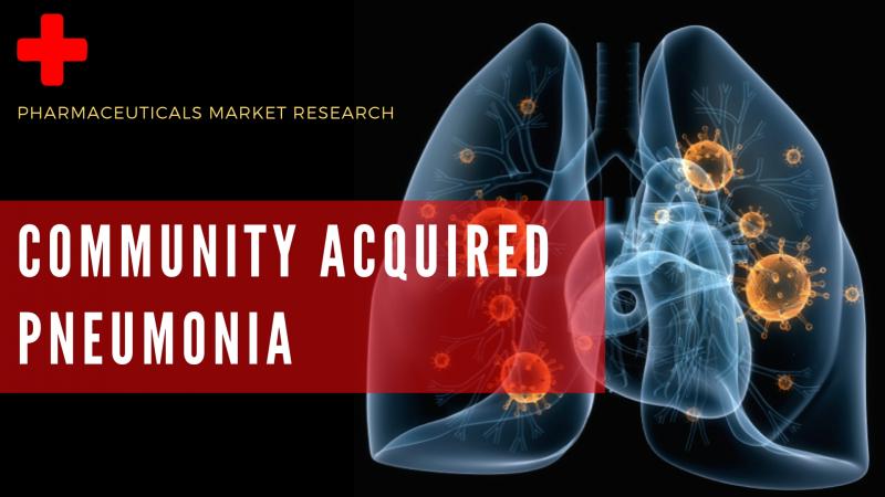 Community Acquired Pneumonia 