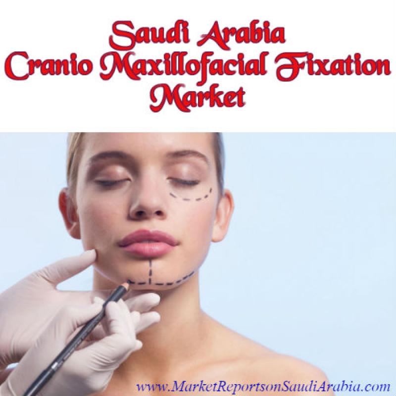 Cranio Maxillofacial Fixation