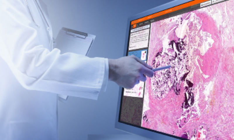Digital Pathology Market
