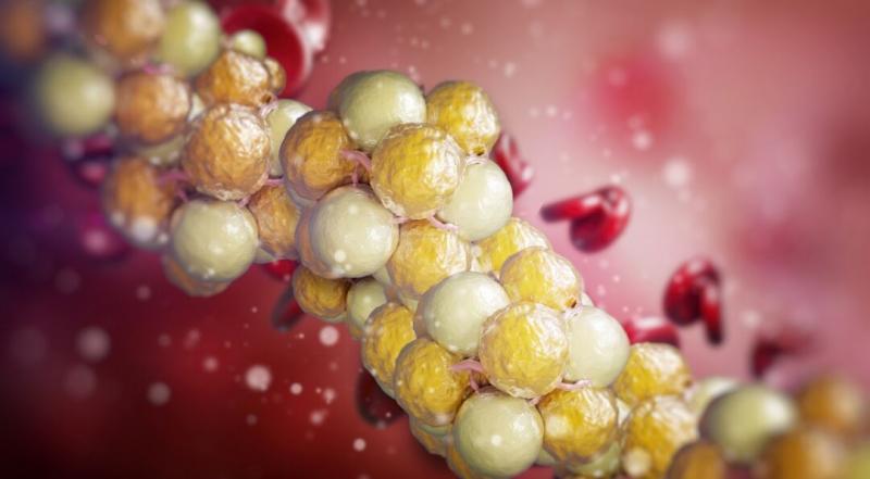 Dyslipidemia pipeline review