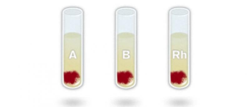 Global Blood Group Typing Market