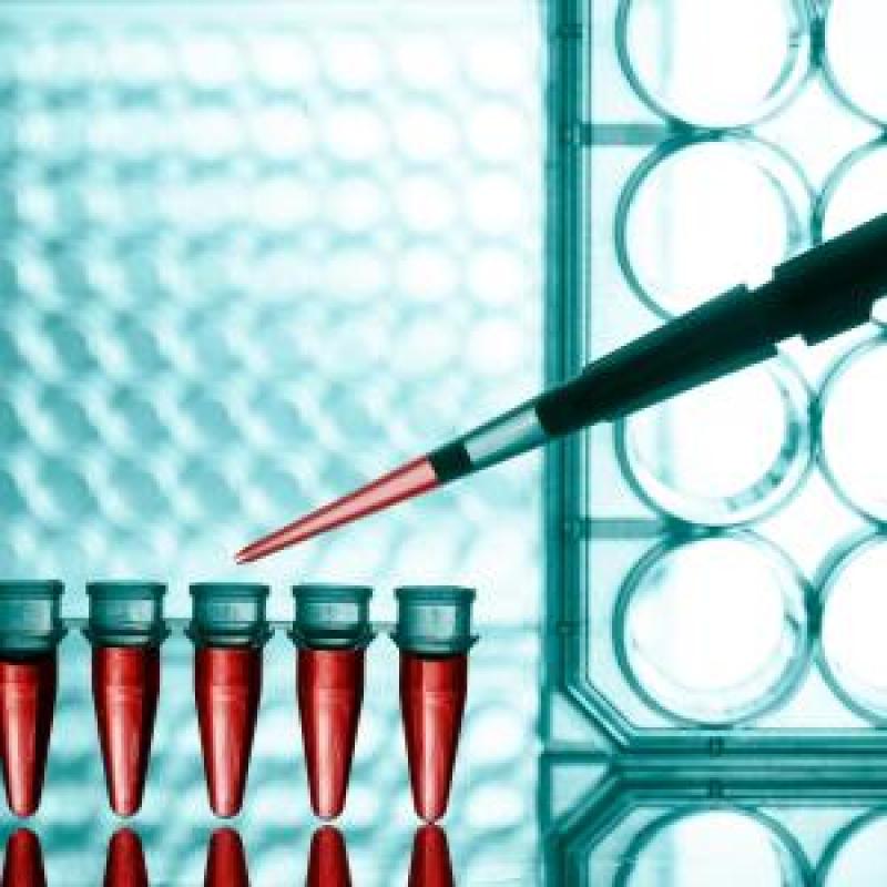 Global Liquid Biopsy Market Global Liquid Biopsy Market