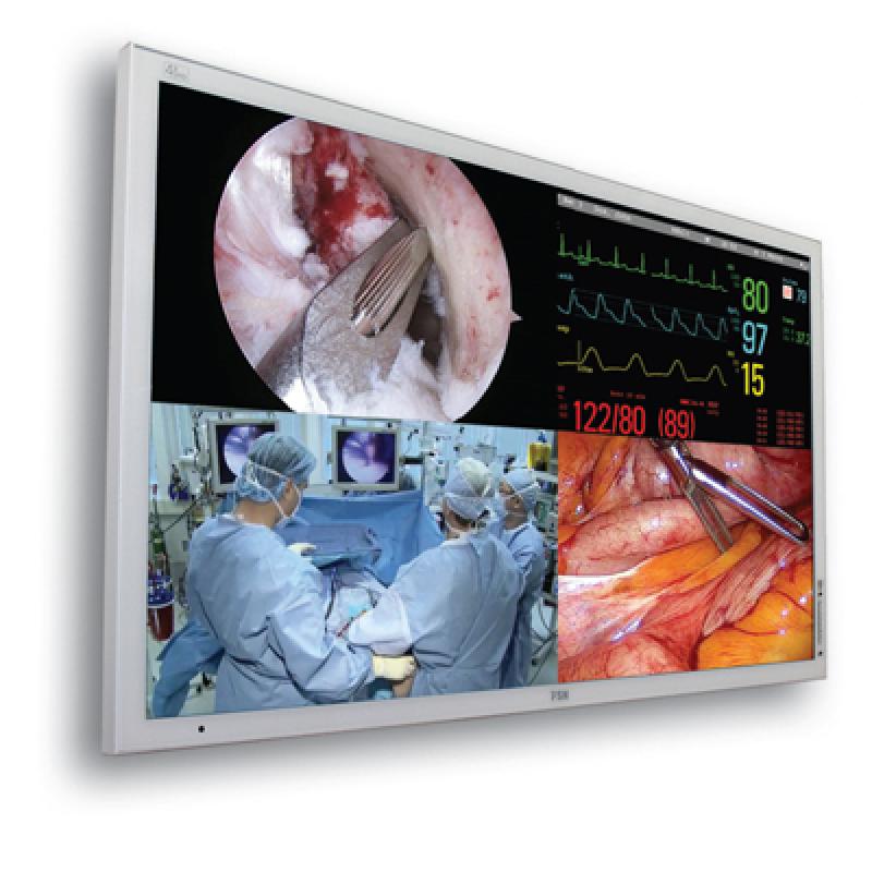 Global Surgical Imaging Market